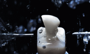 Pope Family Dentistry | Implant Dentistry, Ceramic Crowns and Periodontal Treatment